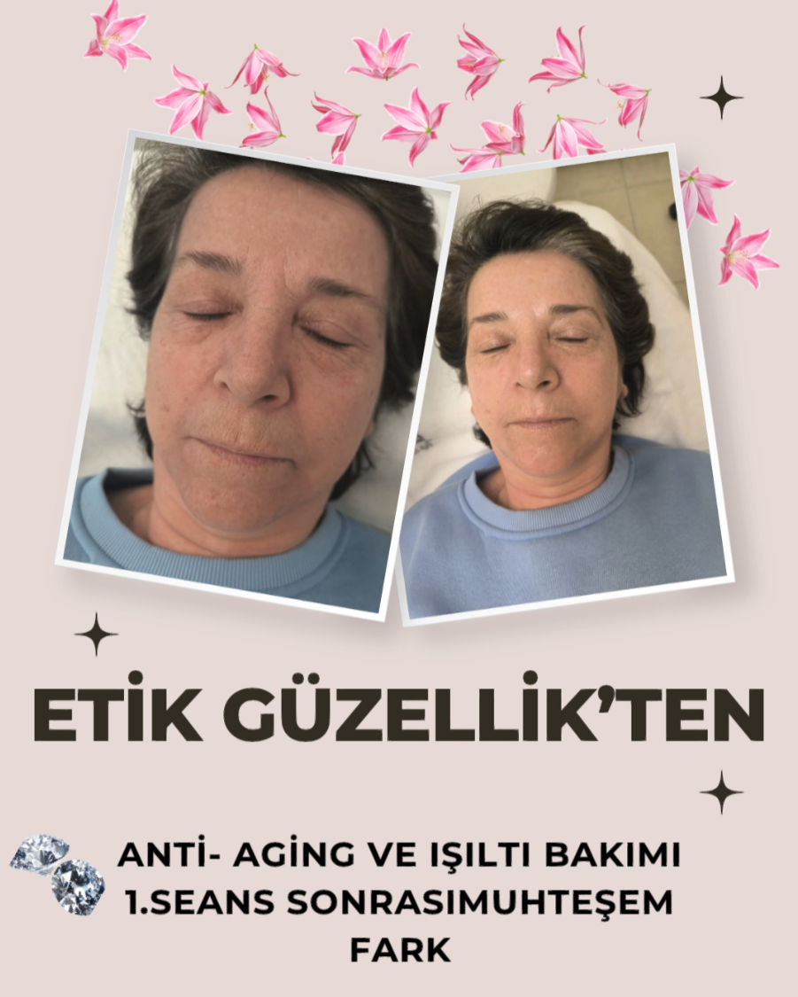 görsel 2026 04 25 001933856